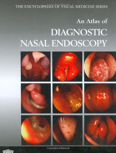 An Atlas Of Diagnostic Nasal Endoscopy 1st Edition Salah D Salman