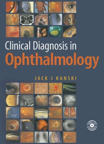 Clinical Diagnosis In Ophthalmology 1st Edition Jack J Kanski