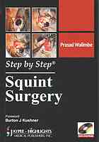 Squint Surgery Walimbe Prasad