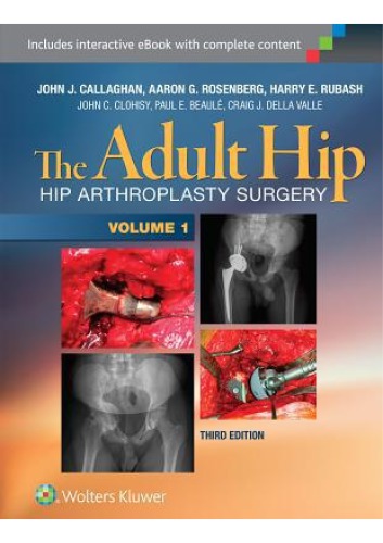 The Adult Hip Hip Arthroplasty Surgery 3rd Edition John J Callaghan