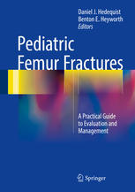 Pediatric Femur Fractures A Practical Guide To Evaluation And Management 1st Edition Daniel J Hedequist