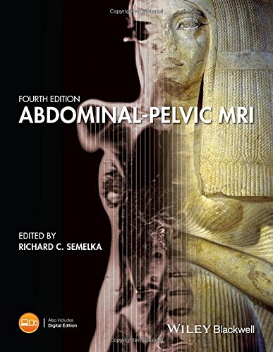 Abdominalpelvic Mri 4th Edition Richard C Semelka Michèle A Brown