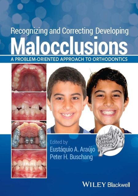 Recognizing And Correcting Developing Malocclusions A Problemoriented Approach To Orthodontics Eustquio A Arajo