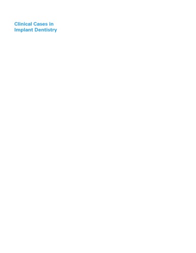 Clinical Cases In Implant Dentistry Karimbux Nadeem Weber Hans Peter