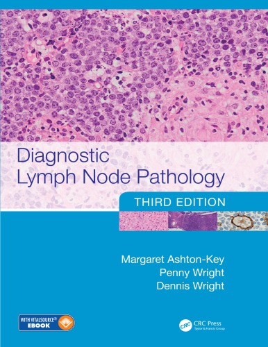 Diagnostic Lymph Node Pathology 3rd Edition Margaret Ashtonkey