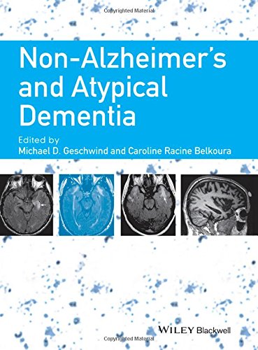 Nonalzheimers And Atypical Dementia 1st Edition Belkoura Caroline Racine Geschwind