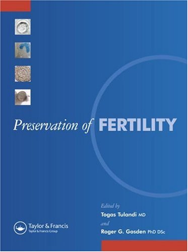 Preservation Of Fertility 1st Edition Togas Tulandi Roger Gordon Gosden