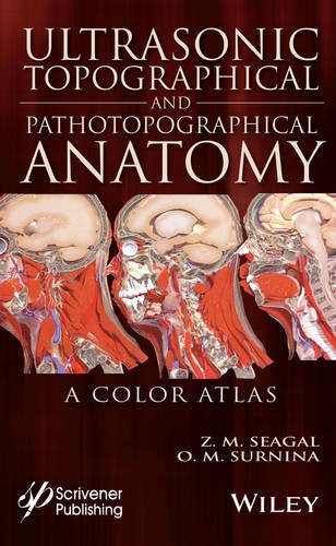 Ultrasonic Topographical And Pathotopographical Anatomy A Color Atlas 1st Edition Seagal