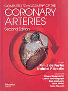 Computed Tomography Of The Coronary Arteries 2nd Ed De Feyter