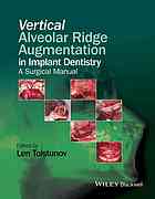Vertical Alveolar Ridge Augmentation In Implant Dentistry Len Tolstunov