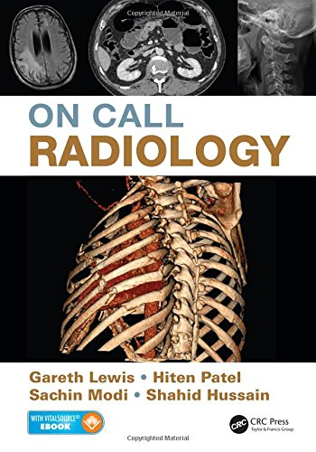 On Call Radiology Gareth Lewis Sachin Modi Hiten Patel Shahid Hussain