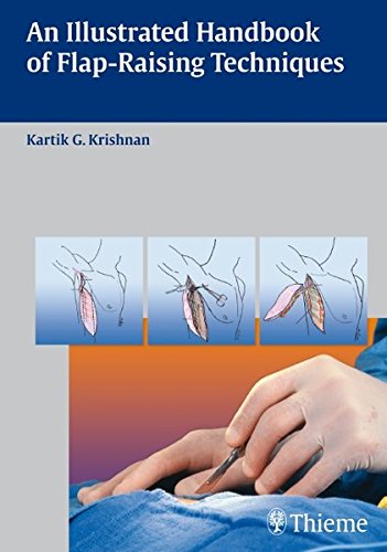 An Illustrated Handbook Of Flapraising Techniques 1st Edition Kartik G Krishnan