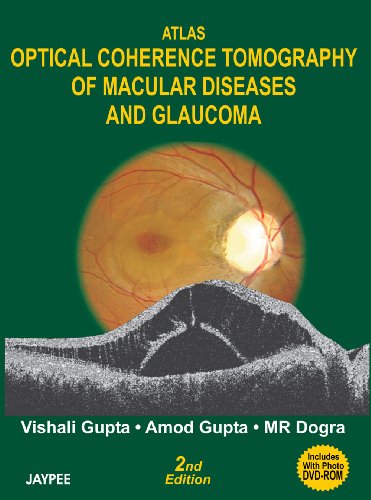 Atlas Optical Coherence Tomography Of Macular Diseases And Glaucoma 2nd Edition Vishali Gupta