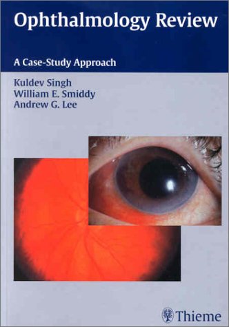 Ophthalmology Review A Case Study Approach 1st Edition Kuldev Singh