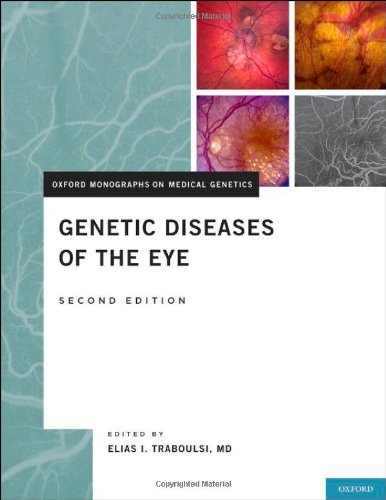Genetic Diseases Of The Eye 2nd Edition Elias I Traboulsi Ed