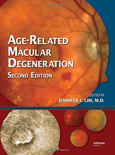 Agerelated Macular Degeneration 2nd Edition Jennifer I Lim Ed