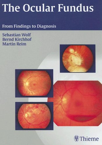 The Ocular Fundus From Findings To Diagnosis 1st Edition Sebastian Wolf