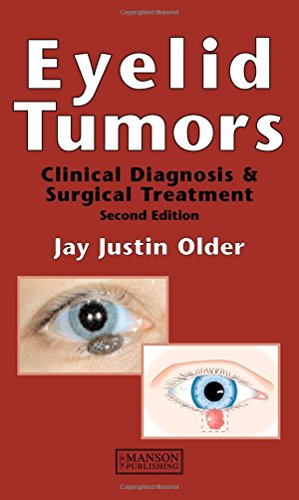 Eyelid Tumours Clinical Diagnosis And Surgical Treatment 2nd Edition Jay Justin Older