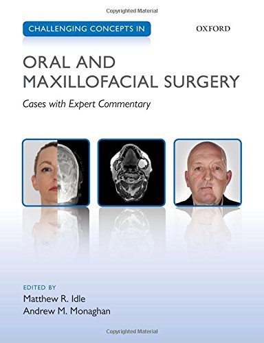 Challenging Concepts In Oral And Maxillofacial Surgery Cases With Expert Commentary 1st Edition Matthew Idle