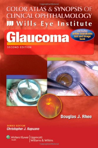 Glaucoma 2nd Ed Douglas J Rhee