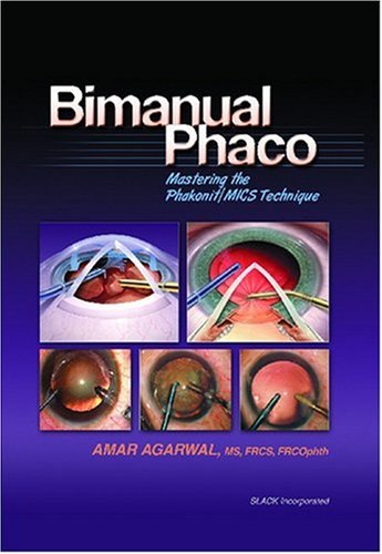 Bimanual Phaco Mastering The Phakonitmics Technique 1st Amar Agarwal