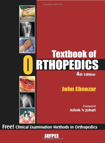 Textbook Of Orthopedics 4th Edition John Ebnezar