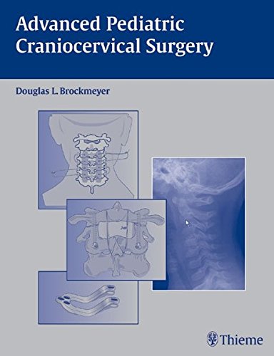 Advanced Pediatric Craniocervical Surgery Brockmeyer Douglas