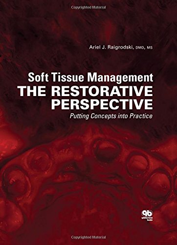Soft Tissue Management The Restorative Perspective Putting Concepts Into Practice 1st Edition Ariel J Raigrodski