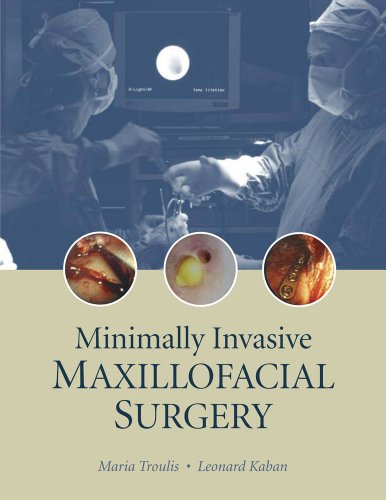 Minimally Invasive Maxillofacial Surgery 1st Edition Maria J Troulis