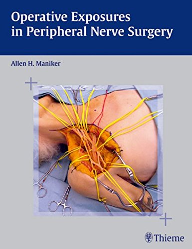 Operative Exposures In Peripheral Nerve Surgery 1st Edition Allen H Maniker