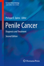 Penile Cancer Diagnosis And Treatment 2nd Edition Philippe E Spiess Eds