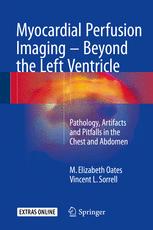 Myocardial Perfusion Imaging Beyond The Left Ventricle Pathology Artifacts And Pitfalls In The Chest And Abdomen 1st Edition M Elizabeth Oates