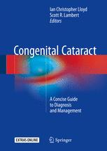 Congenital Cataract A Concise Guide To Diagnosis And Management 1st Edition Ian Christopher Lloyd