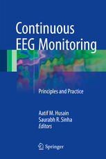 Continuous Eeg Monitoring Principles And Practice 1st Edition Aatif M Husain