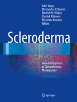 Scleroderma From Pathogenesis To Comprehensive Management 2nd Edition John Varga