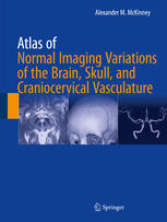 Atlas Of Normal Imaging Variations Of The Brain Skull And Craniocervical Vasculature 1st Edition Alexander M Mckinney Auth