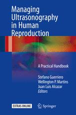 Managing Ultrasonography In Human Reproduction A Practical Handbook 1st Edition Stefano Guerriero