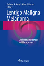 Lentigo Maligna Melanoma Challenges In Diagnosis And Management 1st Edition Kishwer S Nehal