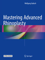 Mastering Advanced Rhinoplasty 1st Edition Wolfgang Gubisch