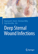 Deep Sternal Wound Infections 1st Edition Prof Dr Med Dr Hc Prof Hc Raymund E Horch