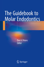 The Guidebook To Molar Endodontics 1st Edition Ove A Peters Eds