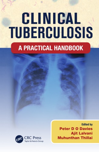Clinical Tuberculosis A Practical Handbook Peter Do Davies