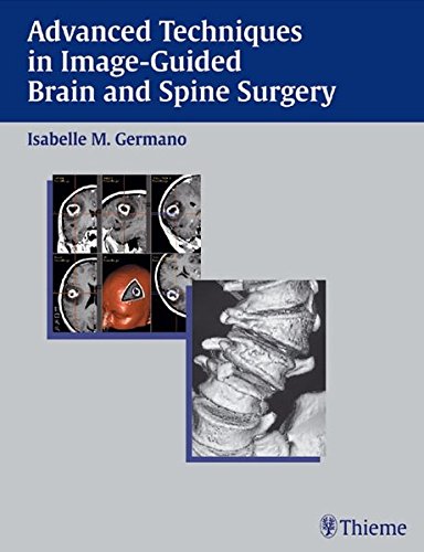 Advanced Techniques In Imageguided Brain And Spine Surgery Germano