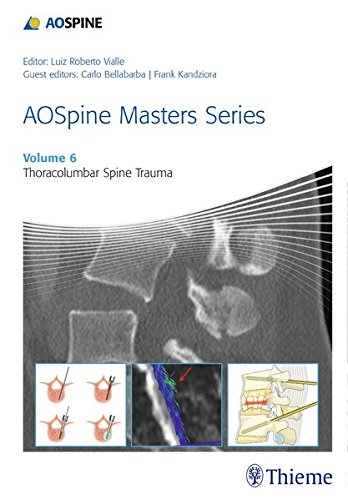 Aospine Masters Series Volume 6 Thoracolumbar Spine Trauma 1st Edition Carlo Bellabarba