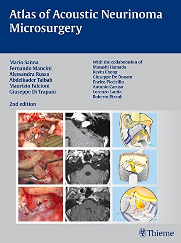 Atlas Of Acoustic Neurinoma Microsurgery Zusarb Mario Sanna Essam Saleh Benedict Panizza Alexandra Russo Abdel Taibahwith The Collaboration Of Refik Caylan Fernando Mancini 2nd Ed Mario Sanna