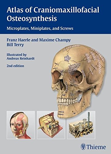 Atlas Of Craniomaxillofacial Osteosynthesis Microplates Miniplatesand Screws 2nd Ed Hrle