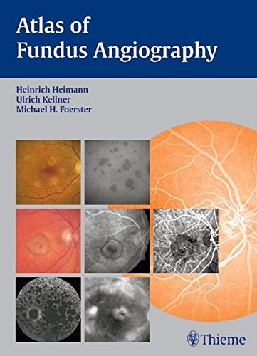 Atlas Of Fundus Angiography Heinrich Heimann Ulrich Kellner Michael H Foerster