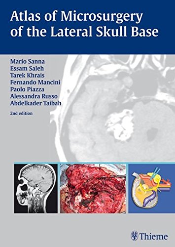 Atlas Of Microsurgery Of The Lateral Skull Base 2nd Ed Mario Sanna