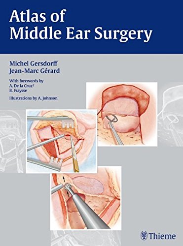 Atlas Of Middle Ear Surgery 1st Edition Gersdorff Michel C H Grard