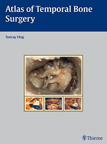Atlas Of Temporal Bone Surgery 1st Edition Ulug Tuncay